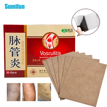 Sumifun 6Pcs/Box Krčne Žile Zdravljenje Mavca Krčne Vaskulitis Naravni Zeliščni Medicinski Obliži C1733