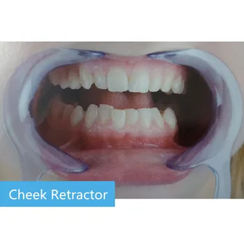 10pc Usta Gag Lice Retractor Širjenje Ustnice Ustni Čisto Odpirač Zobni Intraoral Lice Ustnice Retractor Usta Odpirač Model